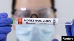 В Африці мавпяча віспа в основному поширюється на людей через інфікованих диких тварин. Однак у Європі, Північній Америці та інших регіонах хвороба поширюється майже виключно серед чоловіків