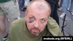 Ілюстрацыйнае фота. 