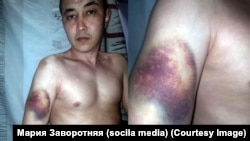 Эмилбек Кимсановдун абакта сабалганы тууралуу адвокаты тараткан сүрөтү. Апрель, 2020-жыл.

